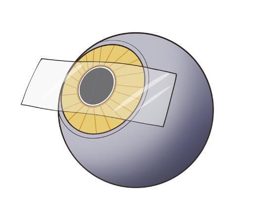 1724039812273958.jpg 人工晶体3.jpg