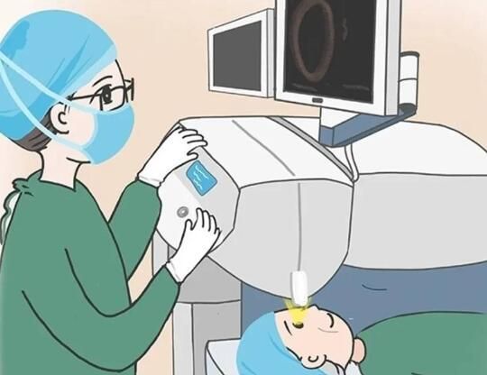 1727153586228963.jpg Smart全激光2.jpg